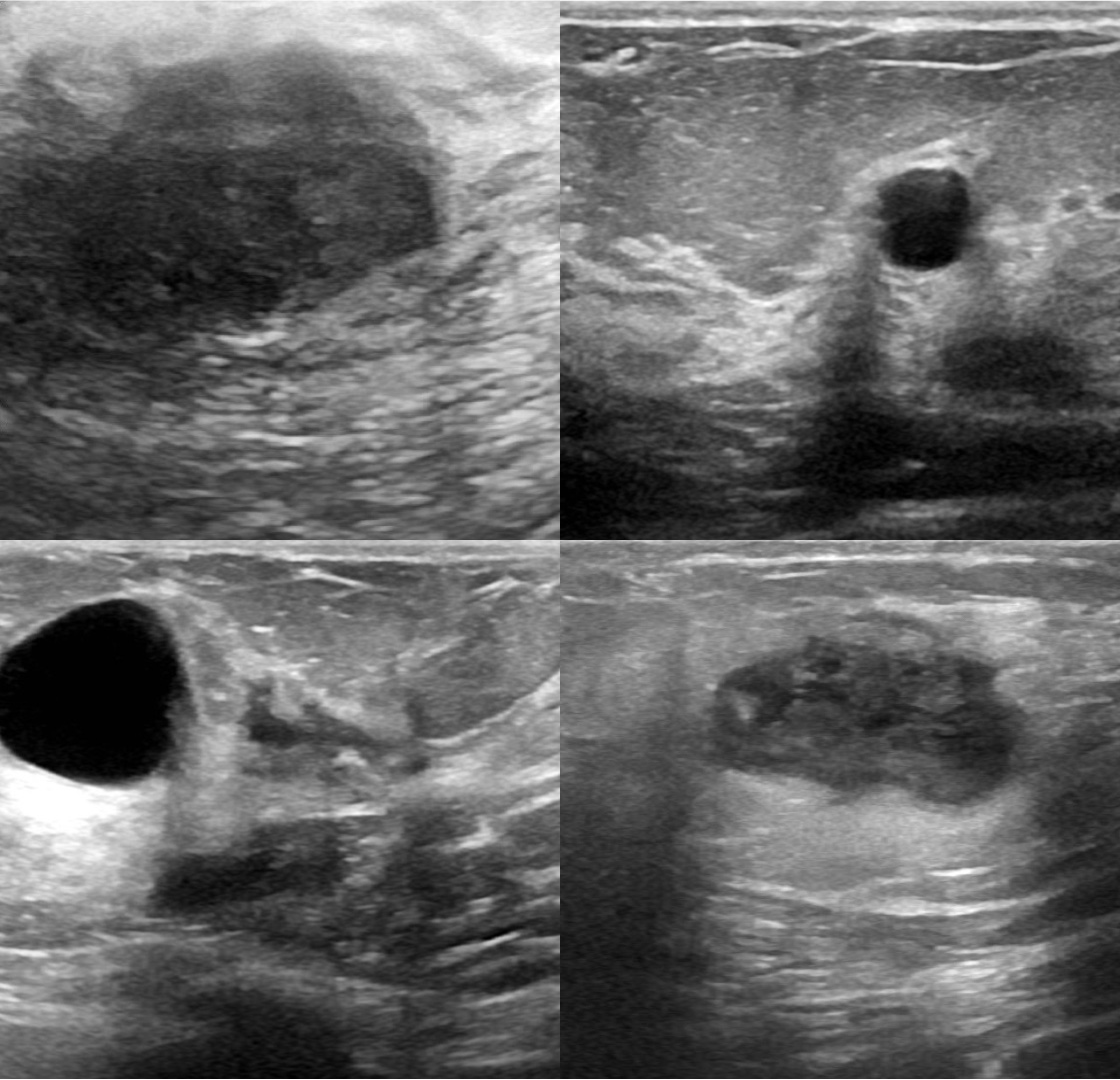 Shows 4 images that are source to our data